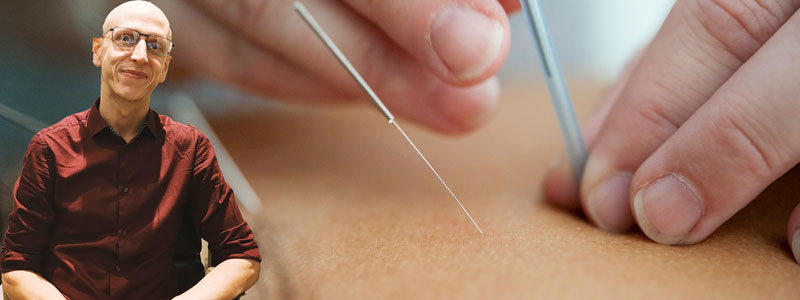Sheridan a qualified acupuncturist